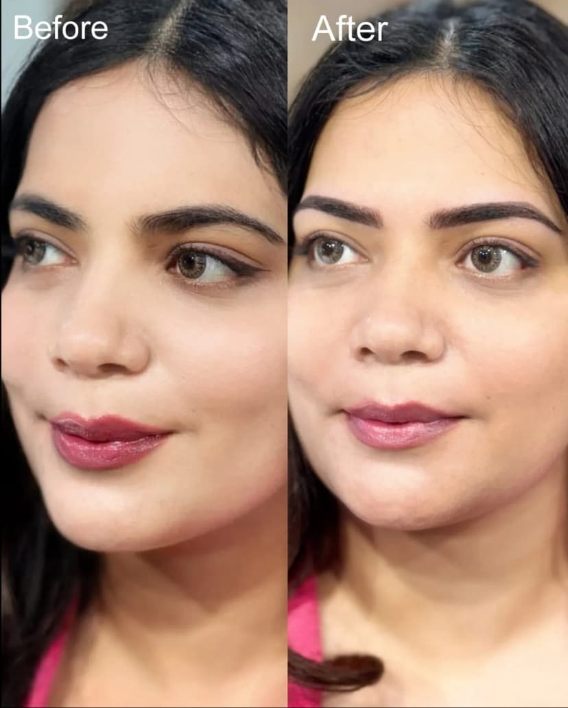 Comparison of Combination brows 
